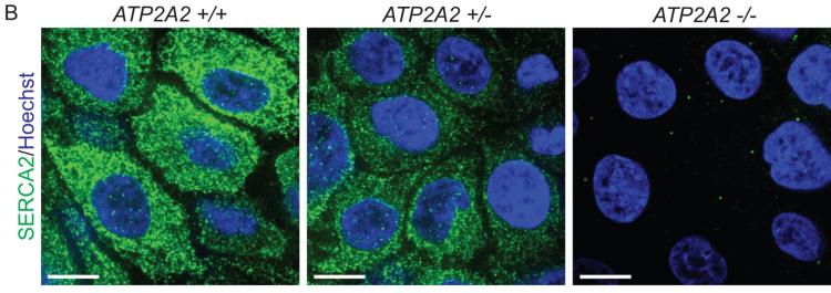 CRISPR/Cas9 editing in human keratinocytes to delete one (+/-) or both copies (-/-) of the disease-linked gene ATP2A2 depletes expression of its encoded protein, SERCA2.