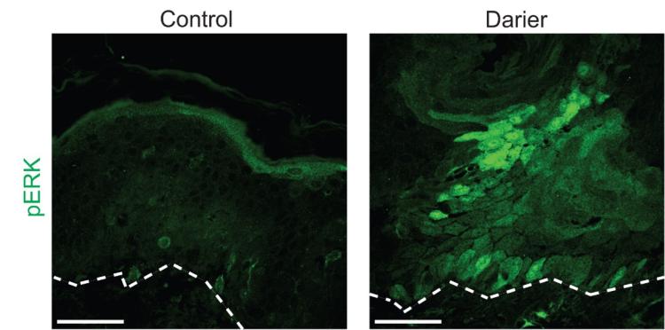 Staining of skin biopsies from control patients compared to those with Darier disease revealed increased activation of MEK's substrate, ERK.