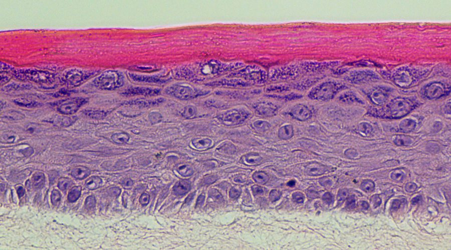 epidermis histology 