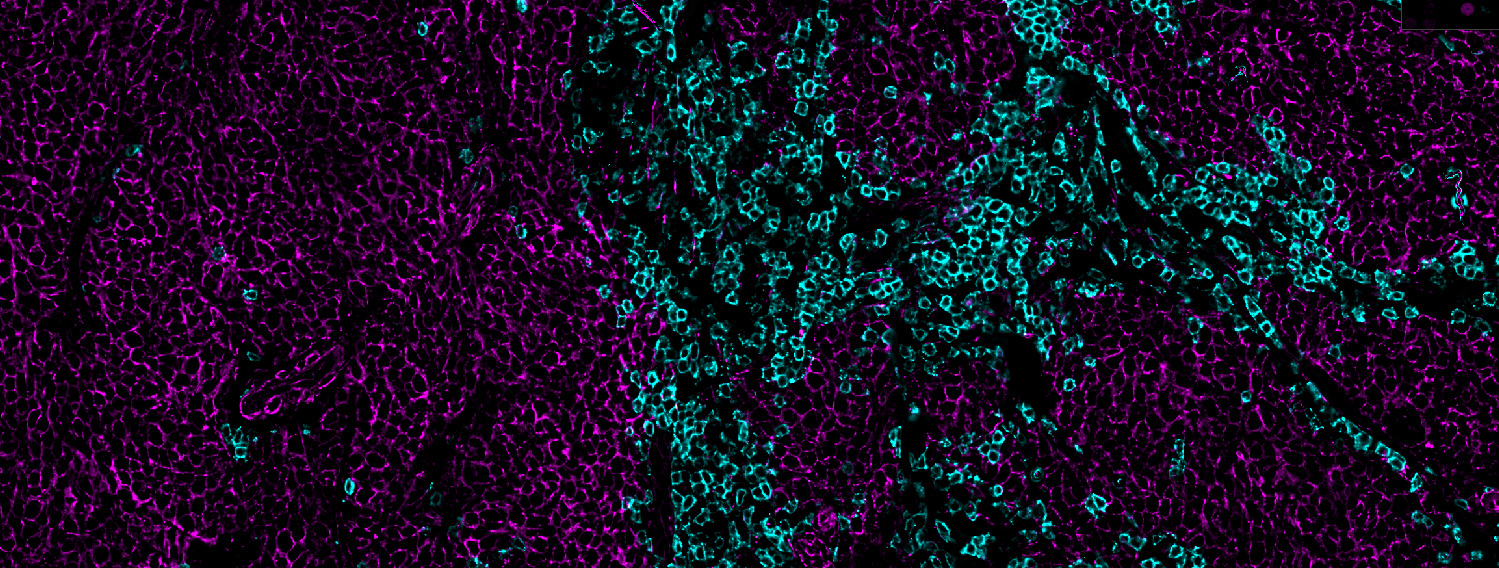 MCC cells