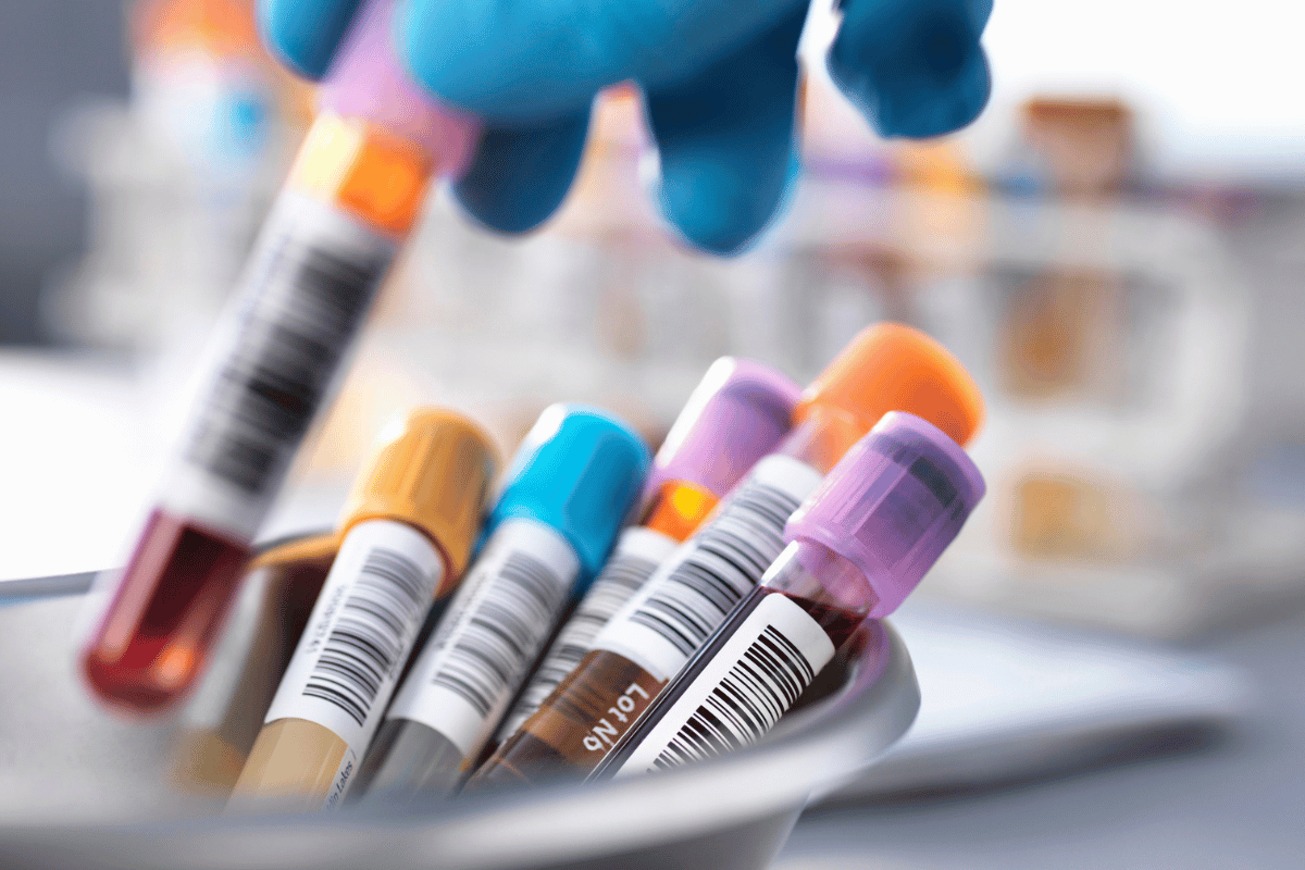 test tubes