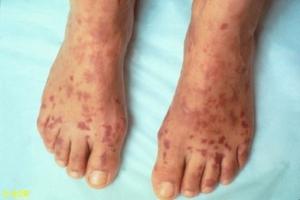 Patient with skin condition 